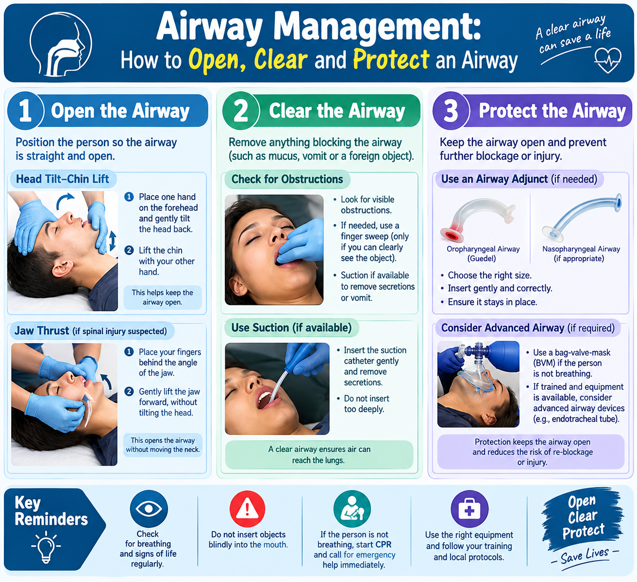 Current First Aid Airway management first aid: Opening, Clearing and Protecting an Airway 0